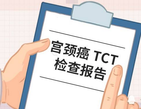 tct检查费用是多少，可以报销吗