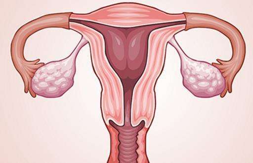 卵巢破裂是怎么回事，哪些行为会导致女性卵巢破裂