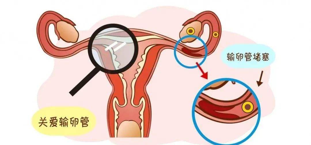 怎么证明输卵管是通的，哪些方法可以自测输卵管