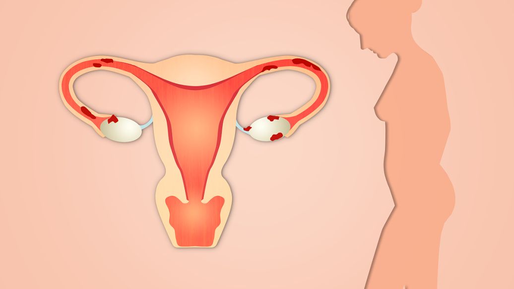 左卵巢囊泡是什么意思