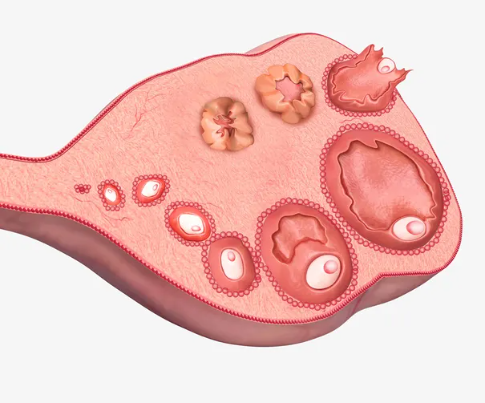 卵巢早衰会出现哪些特征