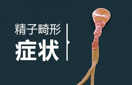 备孕检查男性精子畸形率高还能生孩子吗上周