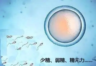 重庆不孕不育专业医院男性精子成活率低怎么办