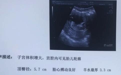 nt值0.15cm是男孩女孩，nt值0.15是女宝的可能性大吗