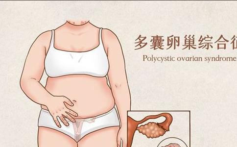 2023郑州多囊卵巢综合征治疗医院名单，附河南多囊治疗专家医生推荐