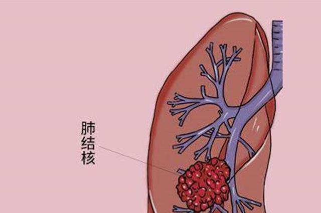 脖子出汗警惕四种病，你可要长点心了