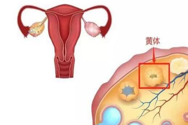 怎么判断自己是不是黄体破裂？看完你心中就有数了