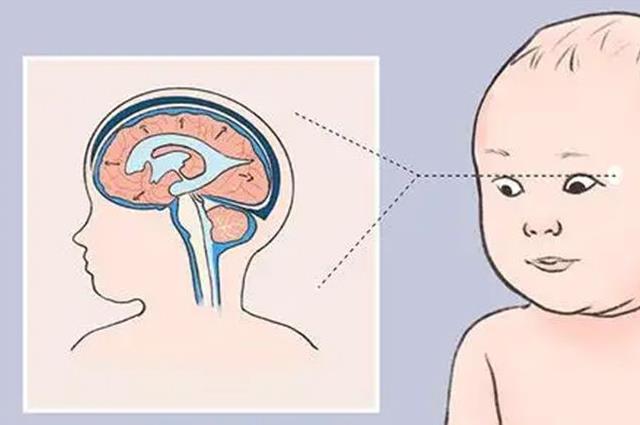 婴儿脑外积水早期症状，可从六个方面进行识别
