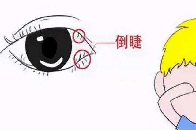 孩子频繁眨眼的六种原因，早知晓早受益