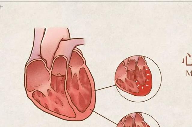 怎么判断自己得了心肌炎？身体出现这些征兆时就要重视了