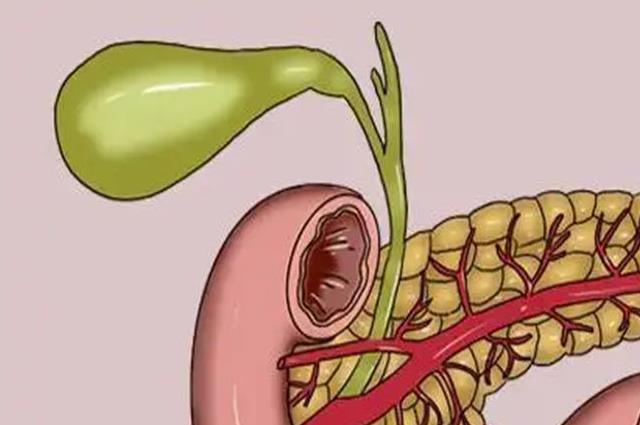 盘点女性胰腺炎的6个症状表现，早发现早治疗