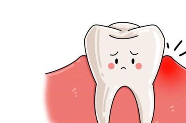 牙龈出血要警惕三种病，千万不可忽视