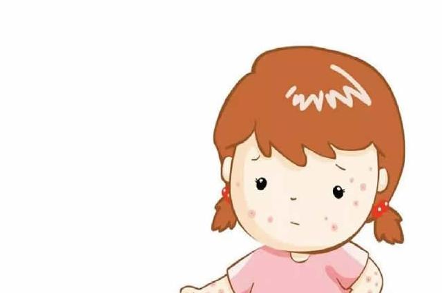 热点直击：宝宝湿疹是怎么引起的？不外乎这4大因素