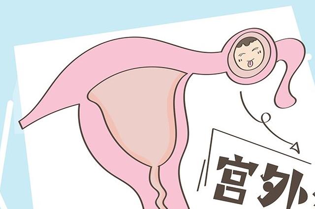 自检指南：查宫外孕最快的方法汇总，3种检查帮你确诊