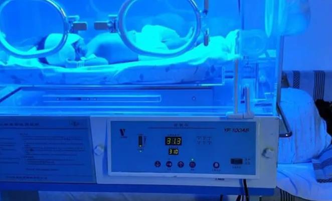 宝宝出生3天黄疸280不住院在家照蓝光能够恢复吗?