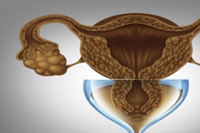 8个症状预示卵巢早衰发生-由此教你自查自己是否有卵巢早衰