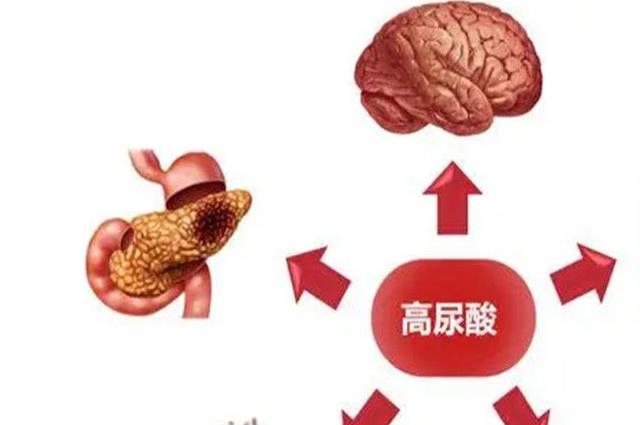 尿酸高的人不宜吃的食物有哪些？这七种食物再馋也要管住嘴