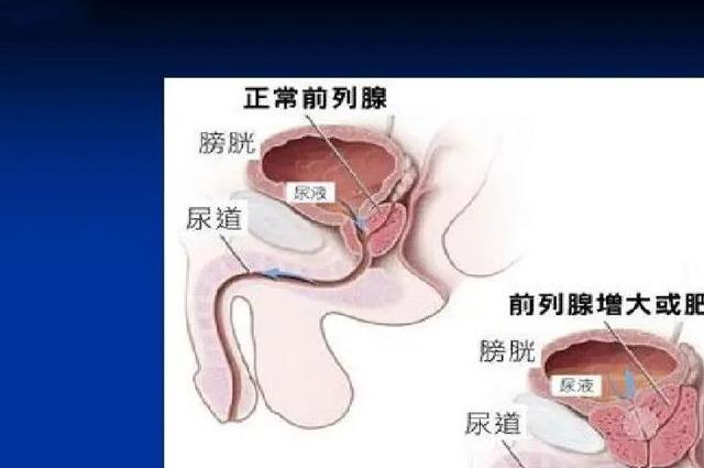 男性得性疾病后八大症状图片，中一种也要及时检查