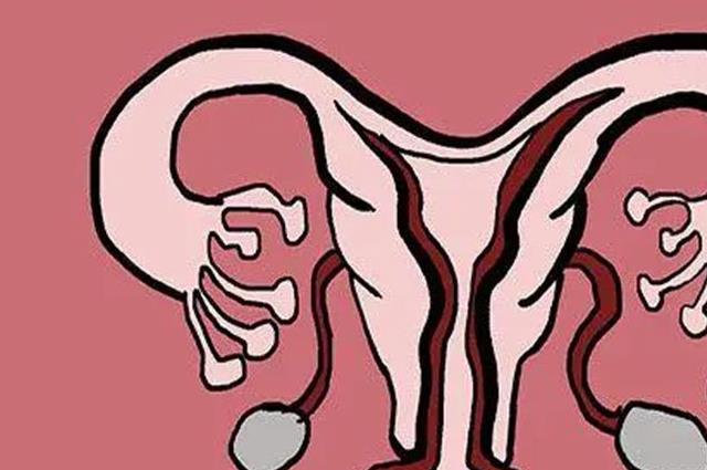 专题速览：子宫横隔怀孕能顺产吗？看看医生怎么说