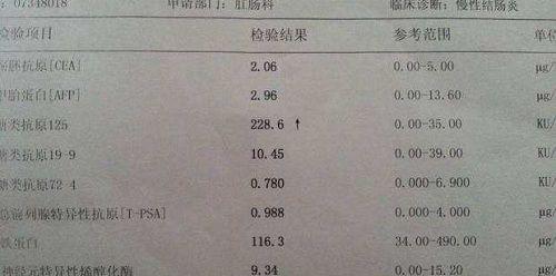 糖类抗原ca125体检报告分析：正常值小于35U/ml