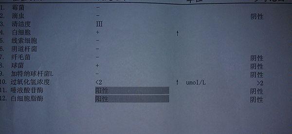 在北医三院做白带常规同房过准吗？