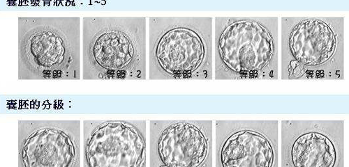 受精卵什么时候会着床?临床经验:12天后着床几率低