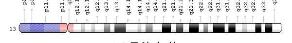 三体、Feingold综合征，13号染色体异常症状不容小觑