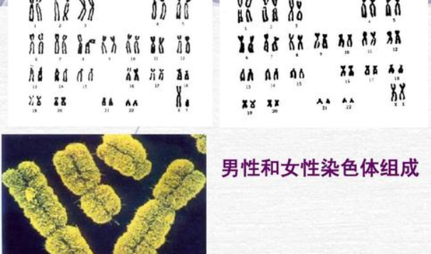 22号染色体异常别着急要孩子，这些高危遗传病要了解