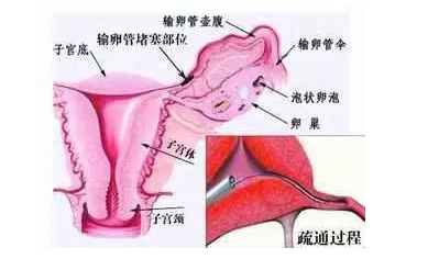 重庆送子鸟医院