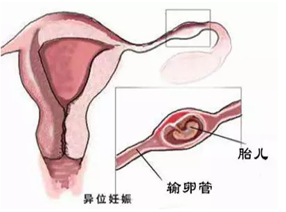 重庆送子鸟医院